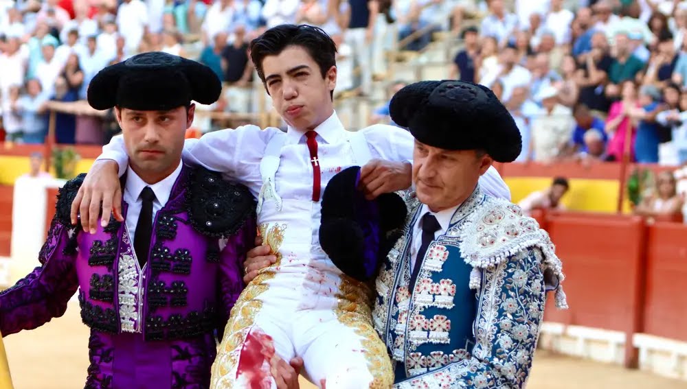 La dureza del toreo: Parte médico y detalles de la salud de Marco Pérez.